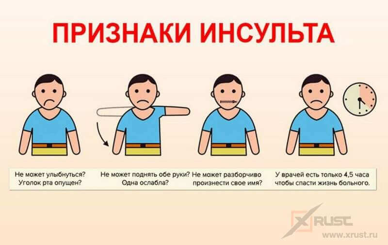Внешние признаки инсульта